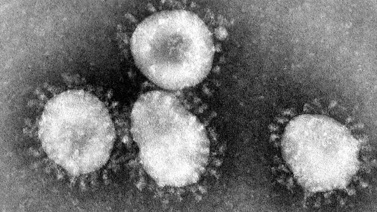 Die Aufnahme des amerikanischen Centers for Disease Control (CDC) zeigt einen Coronavirus unter dem Mikroskop.
