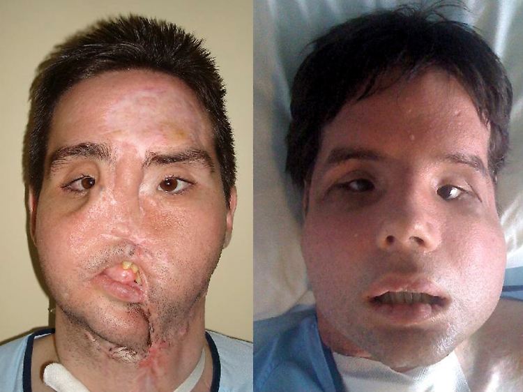 Die Bilder zeigen Oscar vor und nach der Operation.