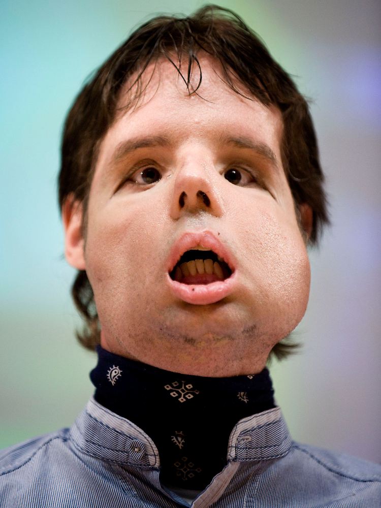 Es wird noch lange dauern, bis Oscar wieder verständlich sprechen kann.