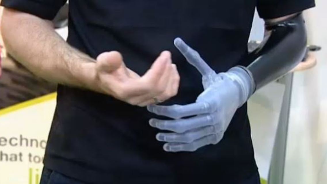 bionik.JPG
