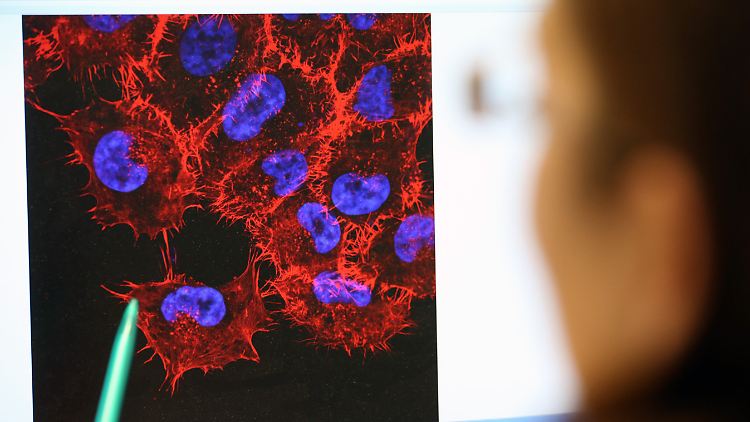 Melanom-Zellen auf einem Monitor des Instituts für Experimentelle Gentherapie und Tumorforschung in Rostock.