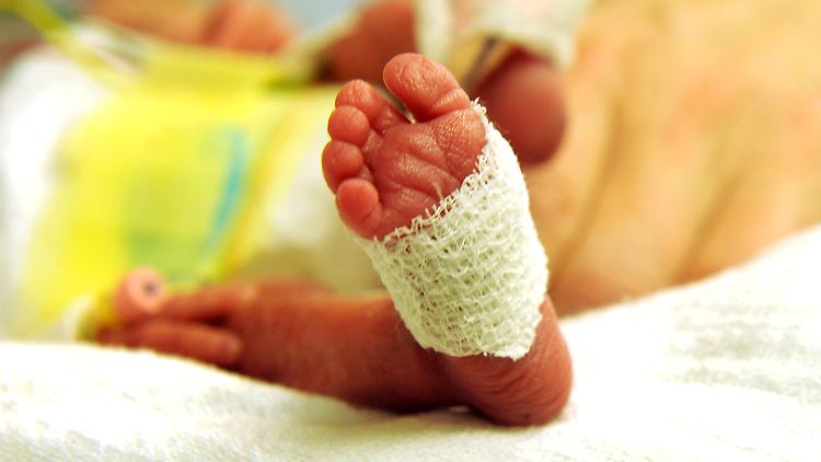 Wie auch dieses Kind kam das Baby in Ungarn deutlich zu früh zur Welt - doch konnte es das Krankenhaus inzwischen verlassen.
