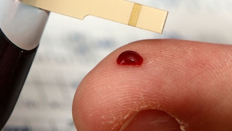 Diabetiker müssen regelmäßig ihren Blutzuckerspiegel messen.