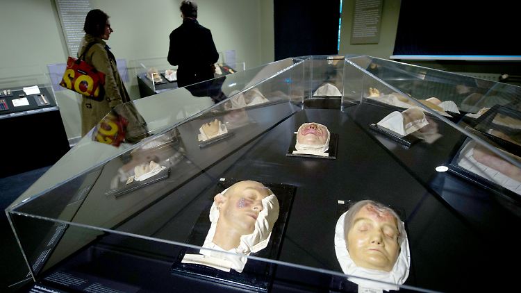 Moulagen, die das "Krankheitsbild Syphilis" zeigen, im Medizinhistorischen Museum Hamburg.