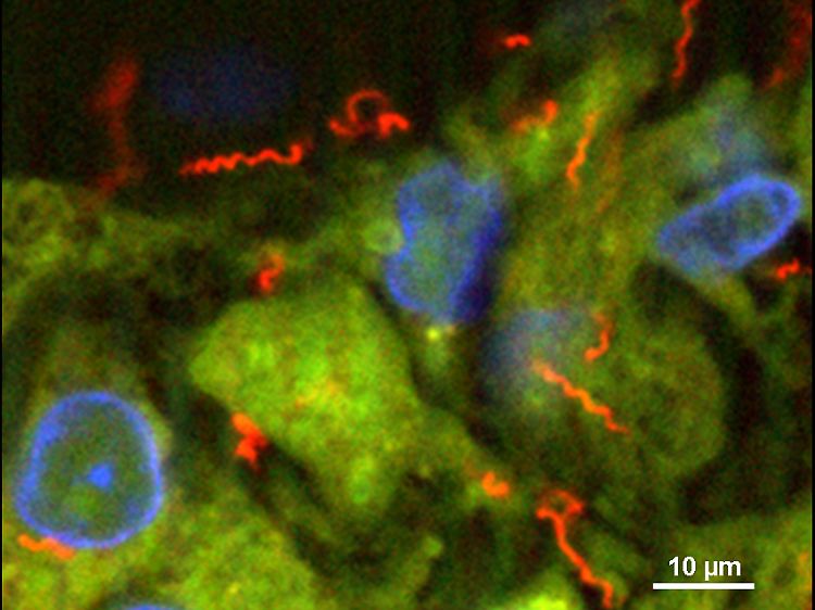 Treponema pallidum, der Syphilis-Erreger, ist bis heute nicht im Labor kultivierbar. Die Arbeitsgruppe Moter identifiziert diese Bakterien mit der molekularbiologischen Färbemethode FISH (Fluoreszenz in situ Hybridisierung). FISH mit einer T. pallidum spezifischen Sonde zeigt die Spiralbakterien (rot) im Gewebe (grün), Zellkerne (blau).