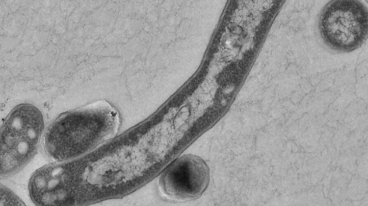 Im Jahr 2012 starben insgesamt 1,3 Millionen Menschen an Tuberkulose.