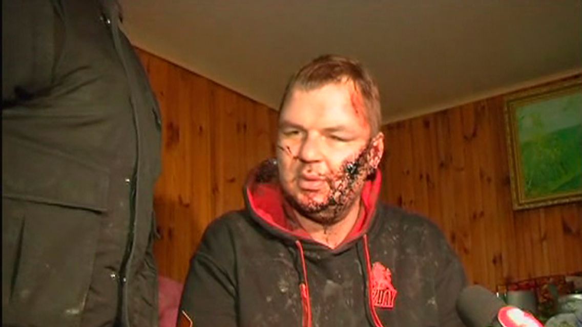 2014-01-31T115600Z_1101608248_GM1EA1V1IY401_RTRMADP_3_UKRAINE-ACTIVIST.JPG746299925756006387.jpg