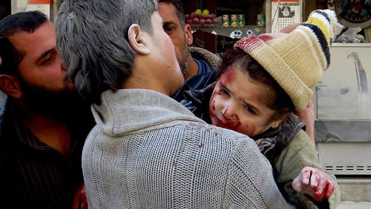 Dieses Kind wurde bei Luftangriffen des Regimes auf Aleppo verletzt.