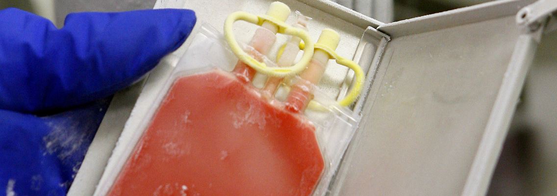 Kann Blut bald direkt aus der Haut eines Menschen gewonnen werden?