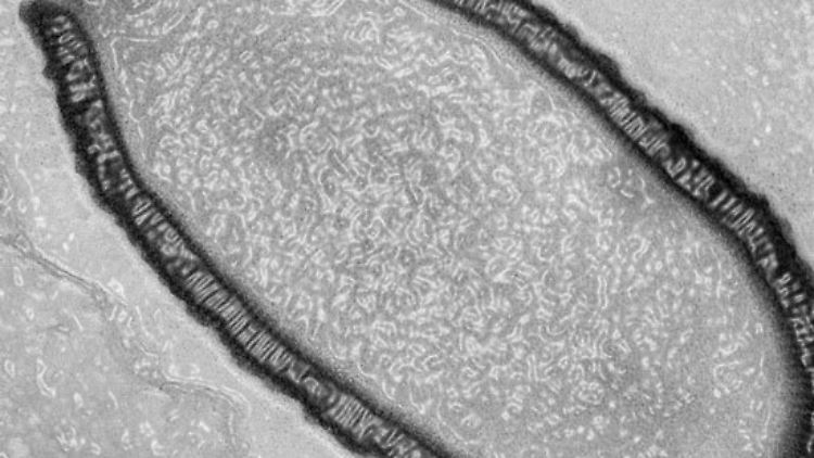 Mikroskopsche Aufnahme eines Pithovirus: Forscher haben das 30.000 Jahre alte, bislang unbekannte Riesenvirus aus dem Permafrostboden zum Leben erweckt.