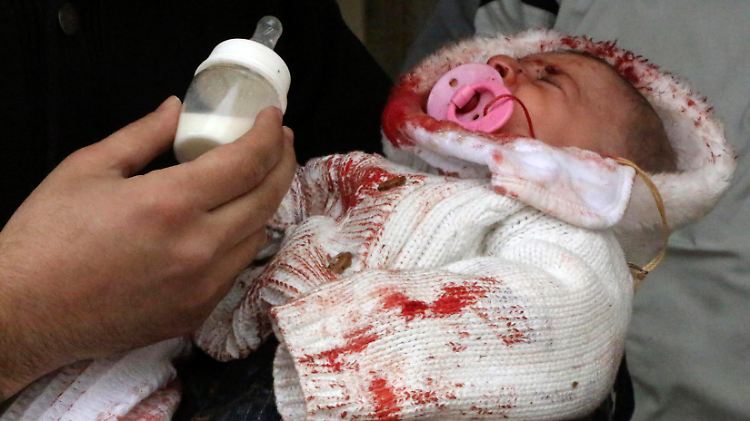 Dieses Baby hat einen Fassbombenangriff einigermaßen unversehrt überlebt. Schwerverletzte Kinder können in Aleppo aber kaum noch angemessen behandelt werden.