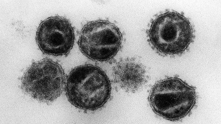 Trotz neuer Behandlungsmöglichkeiten stellt der HI-Virus weltweit eine tödliche Bedrohung dar.