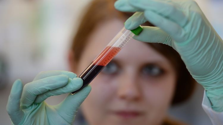 Aus dem Blut der Mutter kann die DNS des Kindes bestimmt werden. Das erlaubt Aussagen über die Wahrscheinlichkeit einer Trisomie.