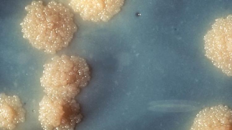Mycobacterium tuberculosis: die gefährliche Bakterienkultur unter dem Mikroskop.