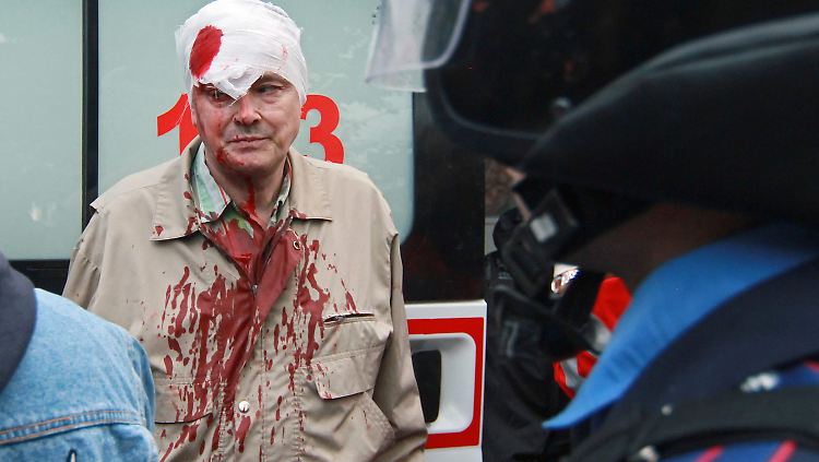 Die Gewalt nimmt wieder zu: Ein verwundeter Pro-ukrainischer Unterstützer.