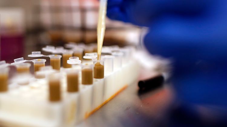 Bevor der Spenderstuhl transplantiert werden kann, muss er untersucht und aufbereitet werden.