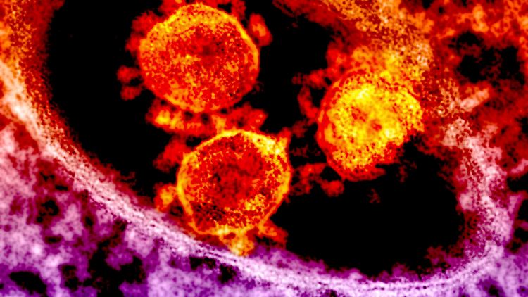 Mers zählt, wie auch Sars, zu den Coronaviren.