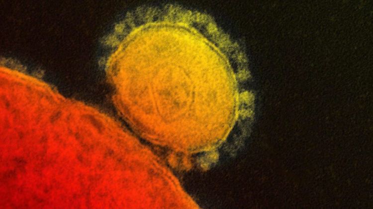 Diese Elektronenmikroskop-Aufnahme zeigt das tödliche Coronavirus Mers, das am Wochenende erstmals in den USA nachgewiesen worden ist.
