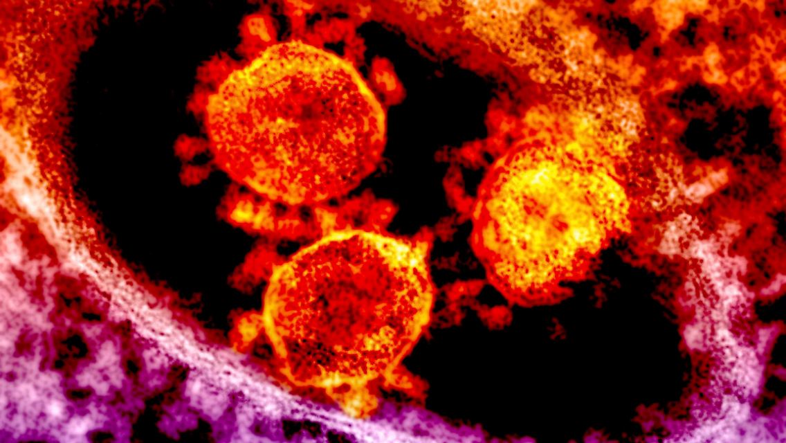 2014-05-02T235408Z_226720478_GM1EA530LQB01_RTRMADP_3_USA-HEALTH-MERS.JPG4064863498625843883.jpg