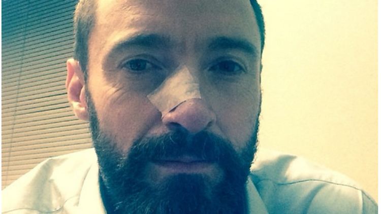 Auf Instagram publizierte Hugh Jackman dieses Foto von sich. Darunter der Aufruf: "PLEASE! PLEASE! WEAR SUNSCREEN!"