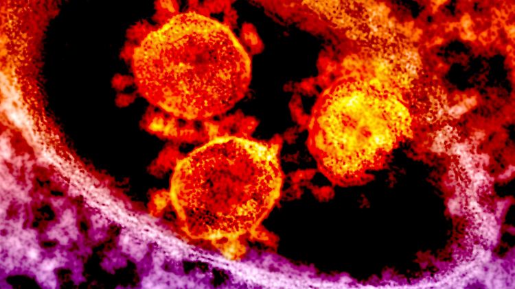 Das Mers-Virus unter dem Elektronenmikroskop.