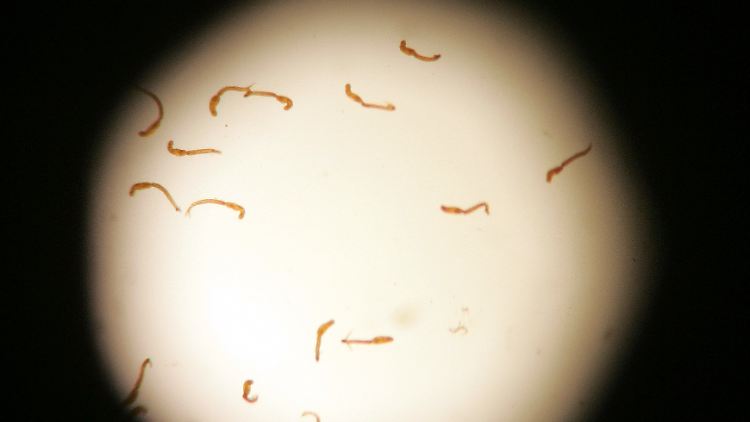 Bilharziose ist eine Wurmkrankheit.