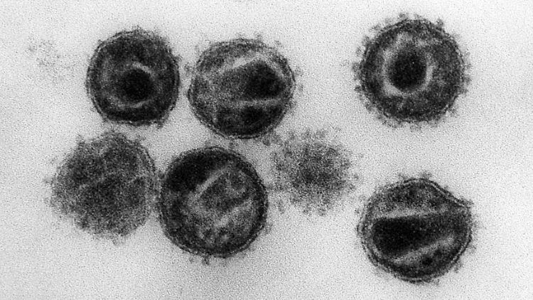 Humane Immunschwäche-Viren (HIV) unter einem Elektronenmikroskop.