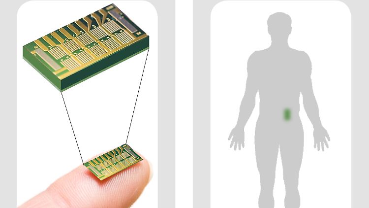 Der neue Mikrochip ist kleiner als ein Fingernagel und wird per Fernsteuerung programmiert.