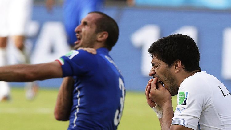 Das tat auch beim Zuschauen weh: Luis Suárez hält sich nach seiner Beißattacke die Vorderzähne.