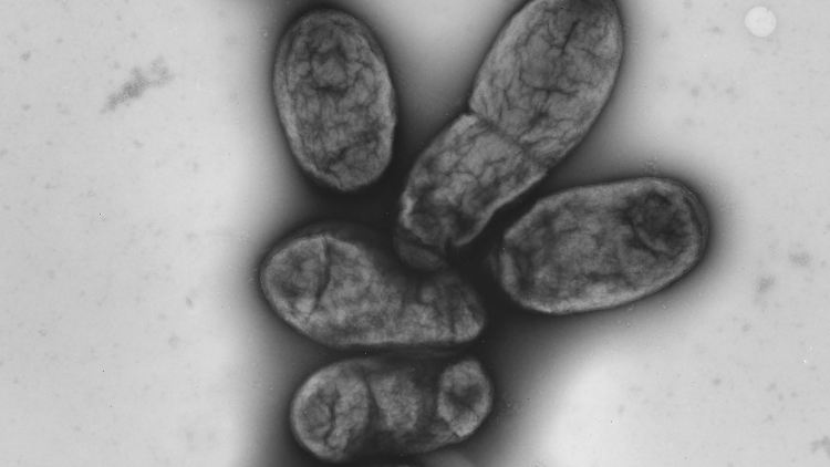 Eine elektronenmikroskopische Aufnahme zeigt das Pestbakterium Yersinia pestis.
