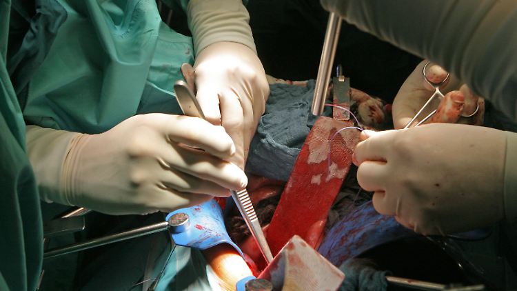 Hier wird einem Spender eine Niere entnommen, die für eine Transplantation vorgesehen ist.