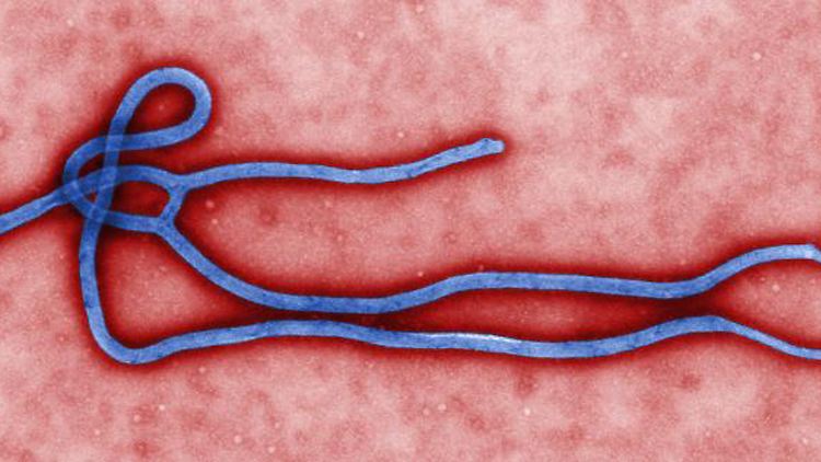 Ästhetische Ansicht eines todbringenden Erregers: Ein Ebola-Virus.