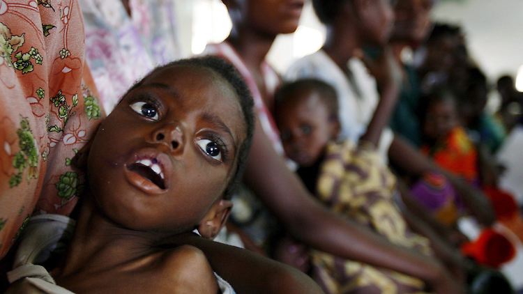 Ein unterernährtes Kind in Malawi: In Afrika fehlt es an fast allem, was in Europa selbstverständlich ist.