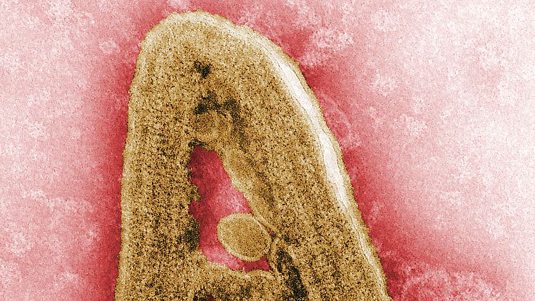 Das Marburg-Virus verläuft in vielen Fällen tödlich.
