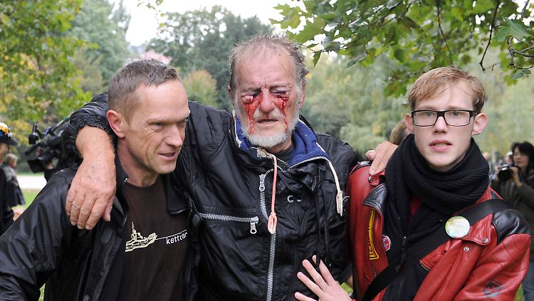 Demonstranten stützen nach der Polizeiaktion einen Verletzten, der durch den Polizeieinsatz sein Augenlicht verliert.