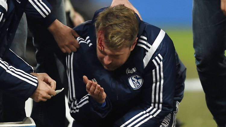 Musste genäht werden: Co-Trainer Sven Hübscher.