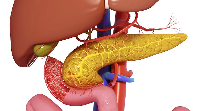 Typ-1-Diabetes tritt meist im Kindesalter auf. Die Bauchspeicheldrüse kann dann kein Insulin mehr produzieren.