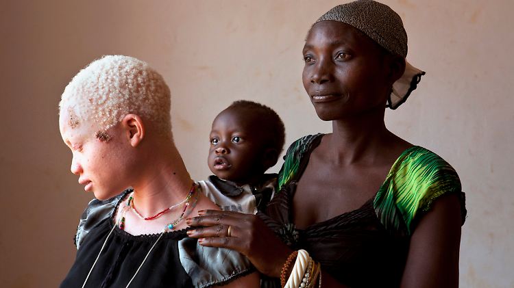 Das Bild zeigt die junge Frau Angel Salvatory mit ihrem Bruder Ezekiel und ihrer Mutter Bestida. Die Lage der Albinos in Tansania ist gefährlich.