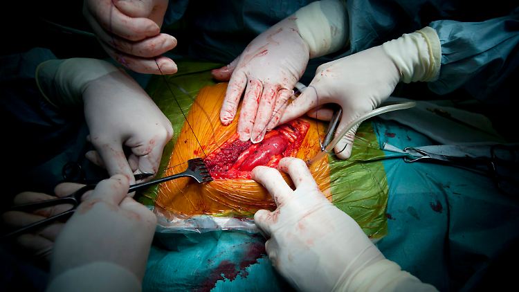 Nach Skandalen bei der Organverteilung hat die Bereitschaft der Deutschen zu spenden nachgelassen.
