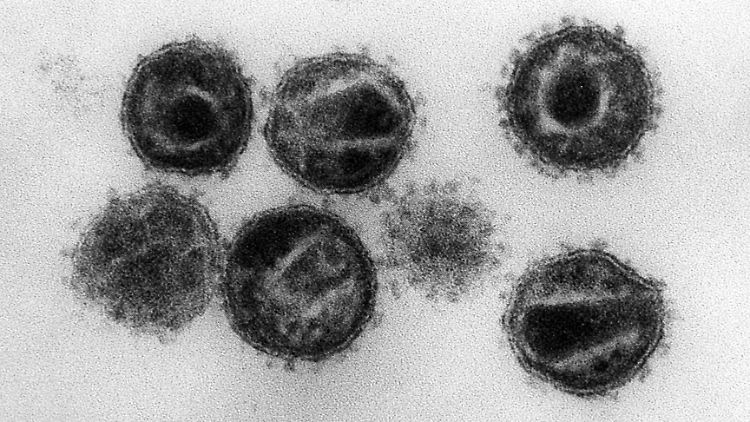 Seit seiner Entdeckung in den 80er Jahren forderte das HI-Virus über 36 Millionen Menschenleben.