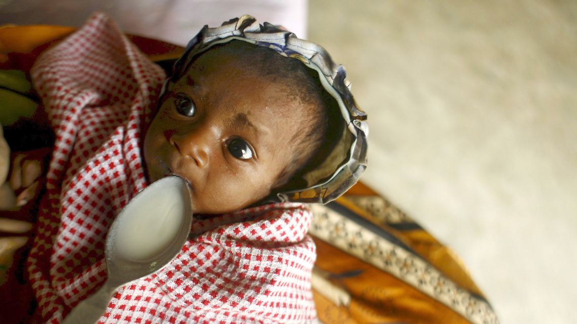 Ein unterernährtes Baby wird in einem Zentrum der German Agro Action (GAA) im Dorf Nosy Varika in Madagaskar versorgt.