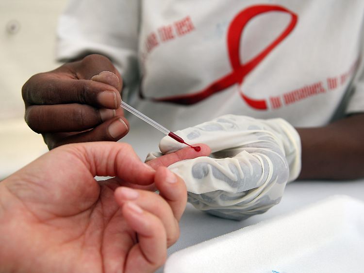 Ein Südafrikanerin unterzieht sich der Blutabnahme für einen HIV-Test.