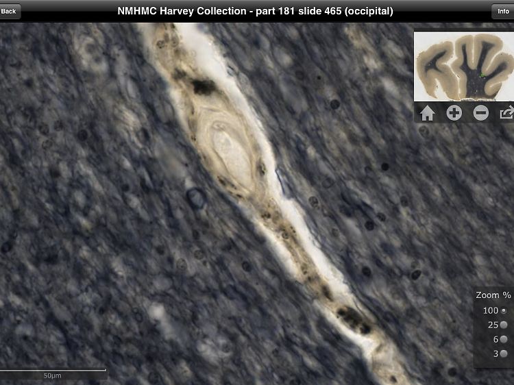 Eine App des National Museum of Health and Medicine, Chicago, erlaubt es Hobbyforschern, Teile von Einsteins Hirn wie bei einem Blick durchs Mikroskop zu untersuchen.