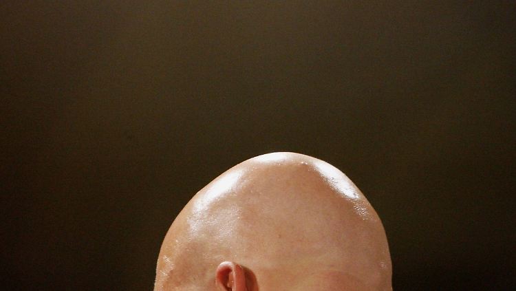 Fast bei jedem Mann werden die Haare im Laufe des Lebens schütter. Vollständiger Haarausfall ist aber eher selten.