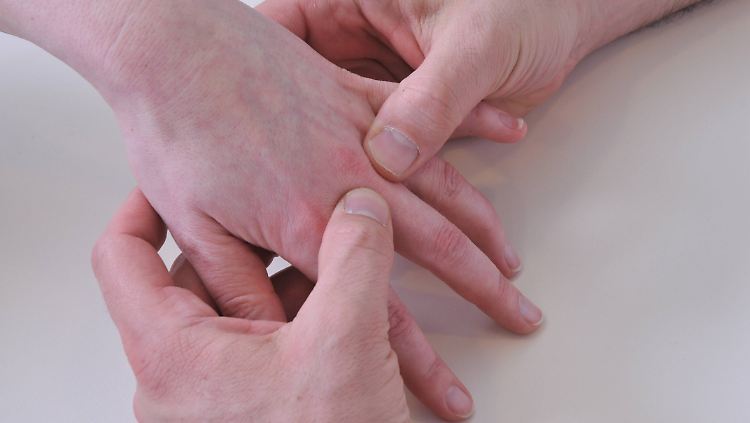 Untersuchung einer Hand auf Rheuma.