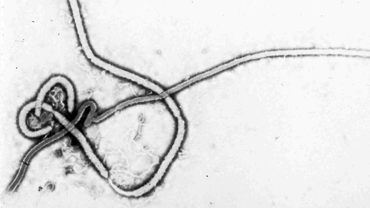 So sieht das Ebola-Virus unter dem Mikroskop aus.