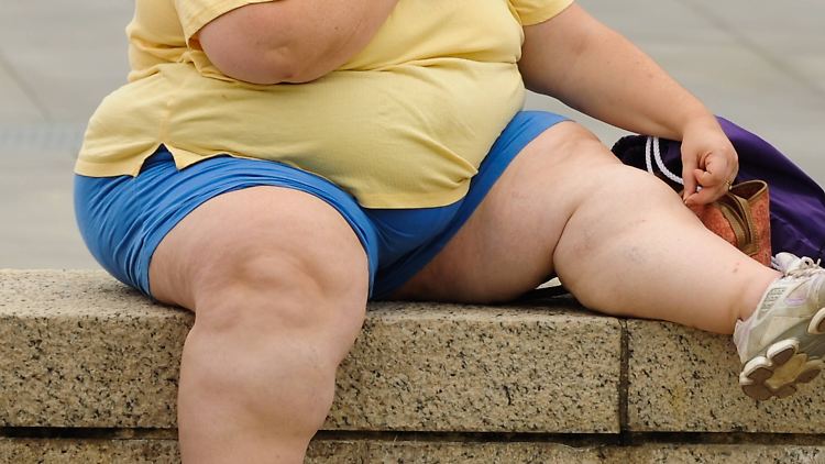 Mit dem BMI errechnet man das Verhältnis von Körpergröße zu Gewicht. Liegt der Wert über 30, spricht man von Fettleibigkeit.