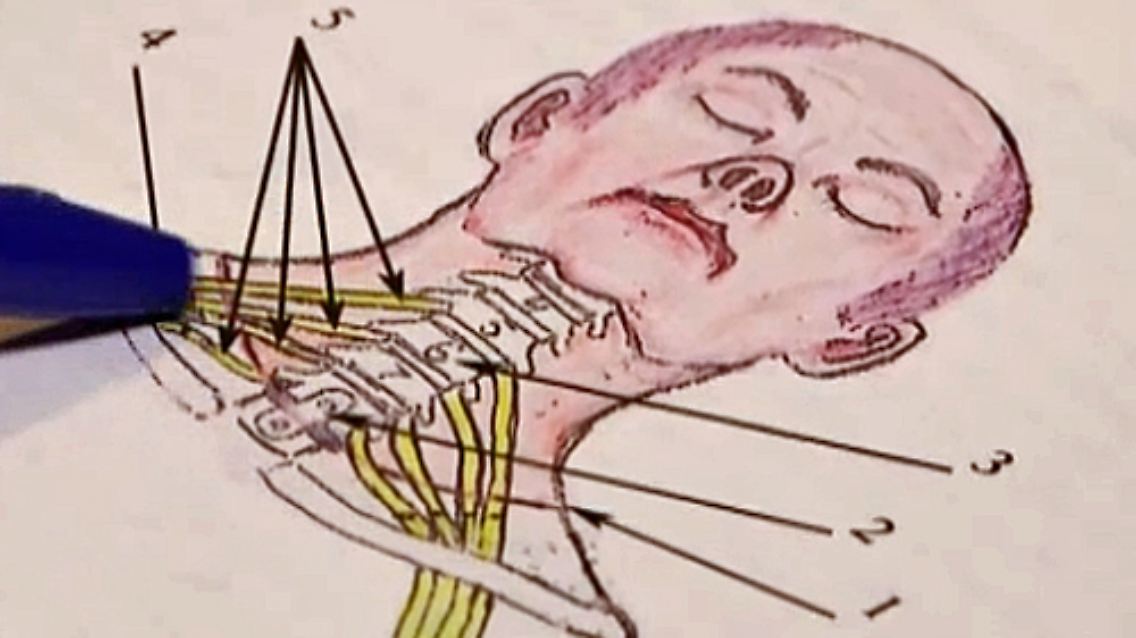 Kopftransplantation.jpg