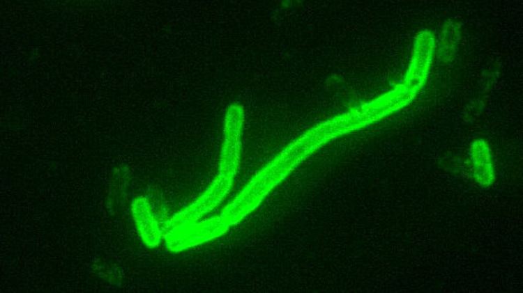 Leuchtendes Bakterium "Yersinia pestis" im Fluoreszenz-Mikroskop.