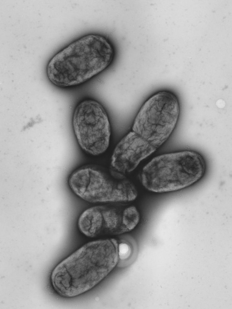 Elektronenmikroskopische Aufnahme des Pestbakteriums Yersinia pestis.